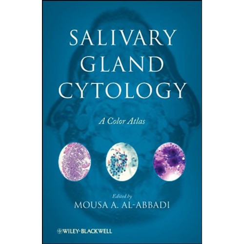 Salivary Gland Cytology: A Color Atlas 