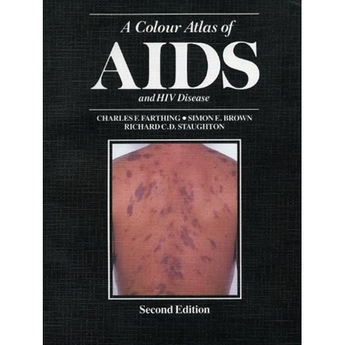 A Colour Atlas Of Aids And Hiv Diagnosis, 2E 