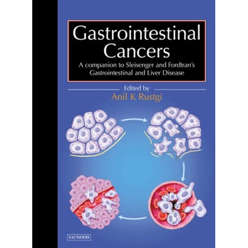 Gastrointestinal Cancers A Companion To Sleis...