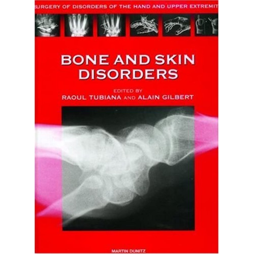 Bone And Skin Disorders - Surgery Of Disorder...