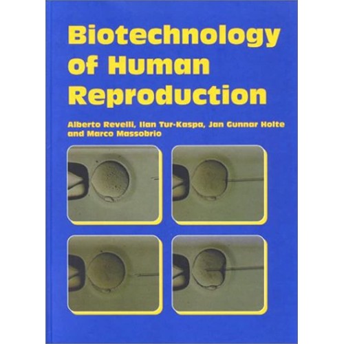 Biotechnology Of Human Reproduction 