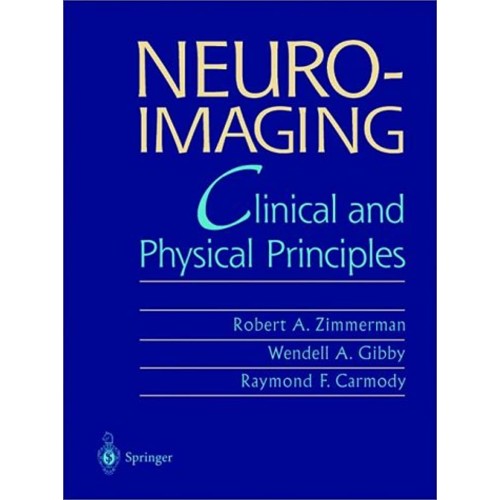 Neuroimaging: Clinical And Physical Principle...