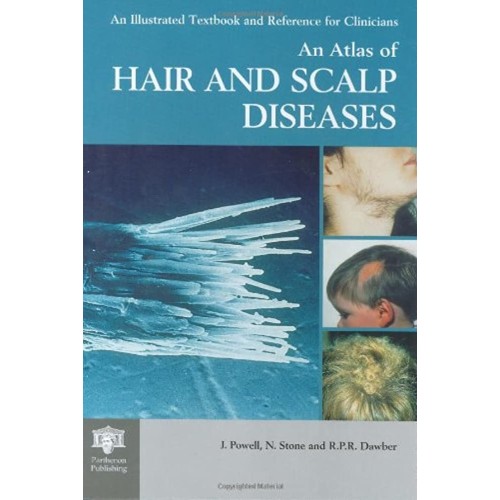 Atlas Of Hair And Scalp Diseases (The Encyclo...