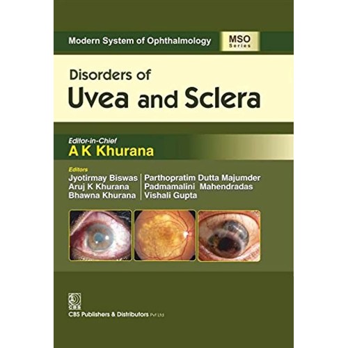 Disorders Of Uvea And Sclera (Mso Series 2016...