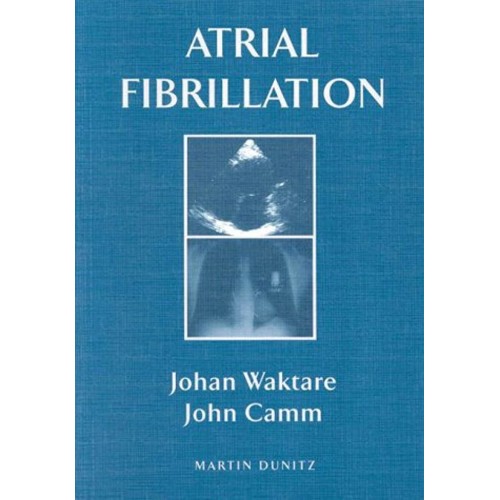 Atrial Fibrillation (Medical Pocketbooks) 