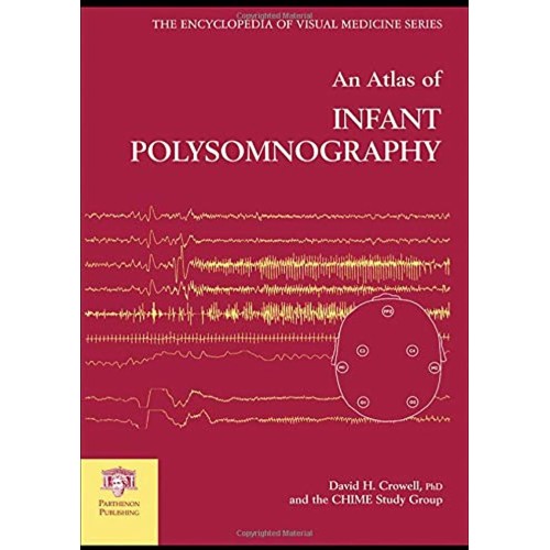 An Atlas Of Infant Polysomnography (The Encyc...