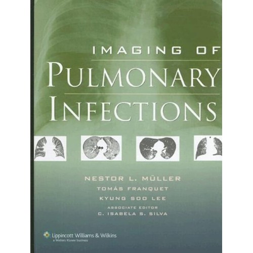 Imaging Of Pulmonary Infections (Hb 2007) 