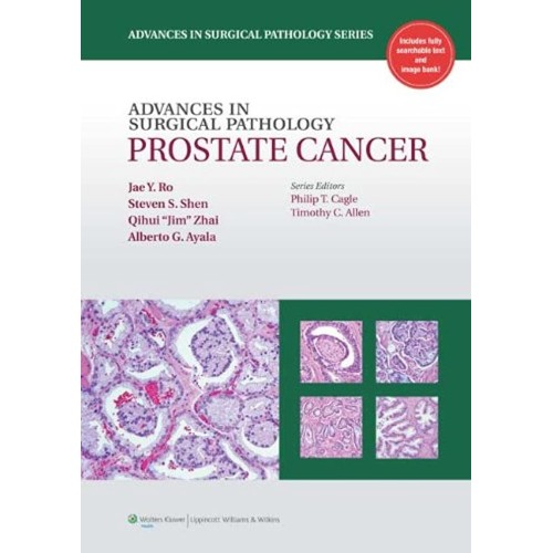 Advances In Surgical Pathology Prostate Cance...