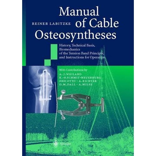 Manual Of Cable Osteosyntheses 