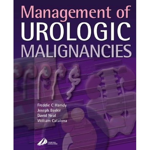 Management Of Urologic Malignancies 