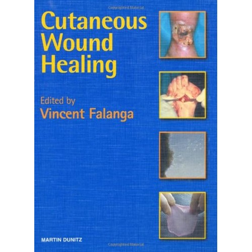 Cutaneous Wound Healing 