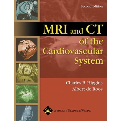 Mri And Ct Of The Cardiovascular System 2Ed (...