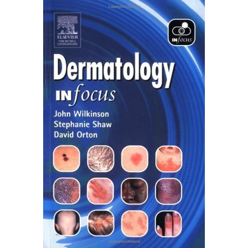 Dermatology In Focus 