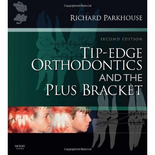 Tip Edge Orthodontics And The Plus Bracket 2E...