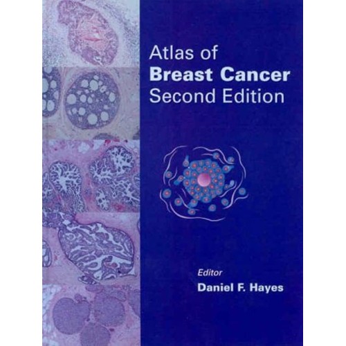 Atlas Of Breast Cancer, 2/E 