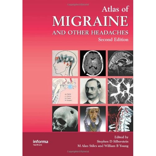 Atlas Of Migraine And Other Headaches 