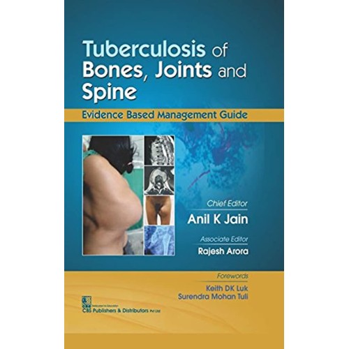 Tuberculosis Of Bones Joints And Spine (Hb 20...