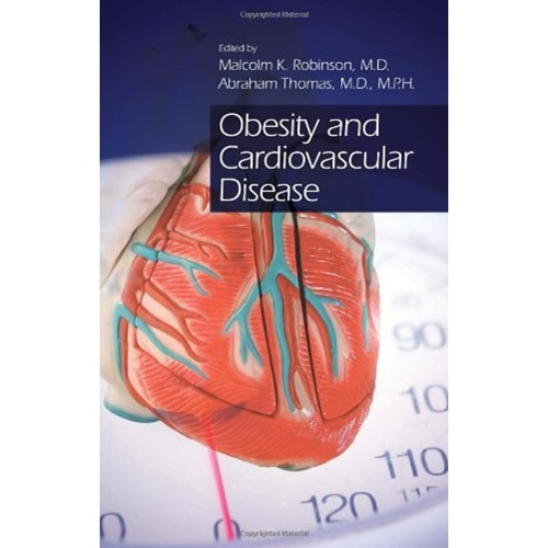 Obesity And Cardiovascular Disease 