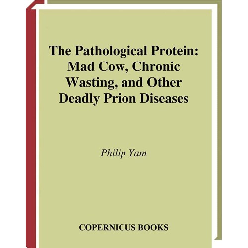 The Pathological Protein Mad Cow Chronic Wast...