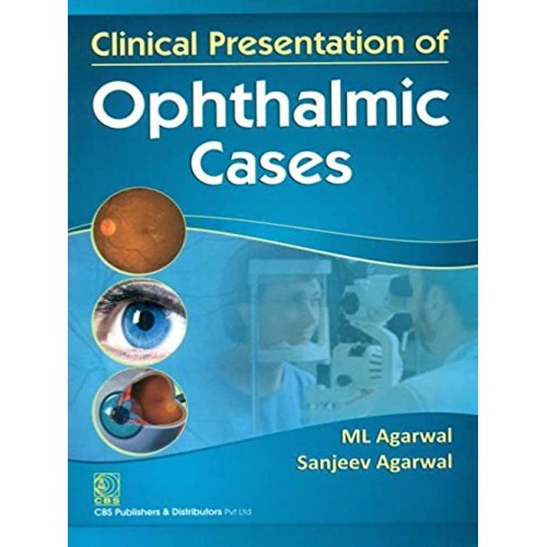 Clinical Presentation Of Opthalmic Cases (Pb2...