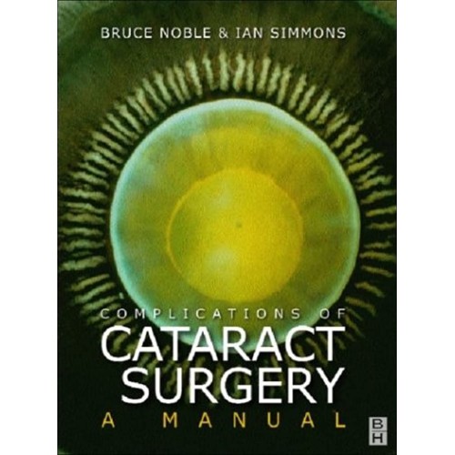 Complications Of Cataract Surgery A Manual 2E...