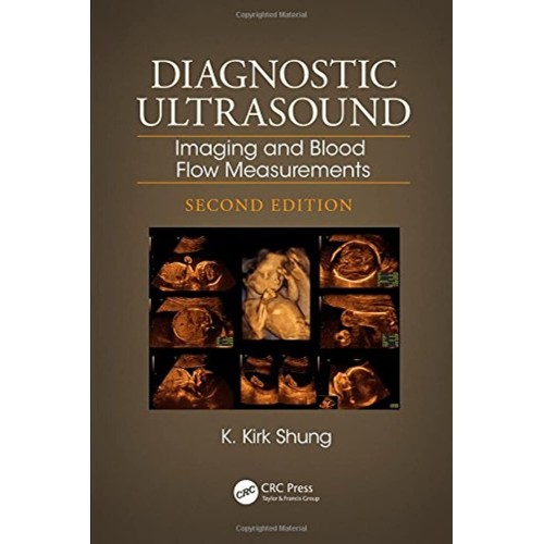 Diagnostic Ultrasound Imaging And Blood Flow ...