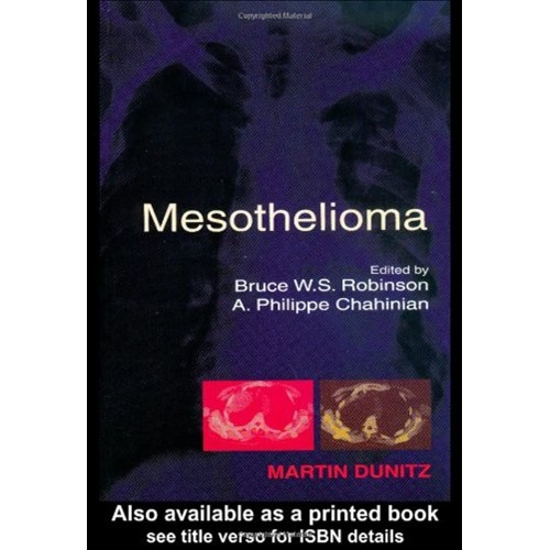 Mesothelioma 