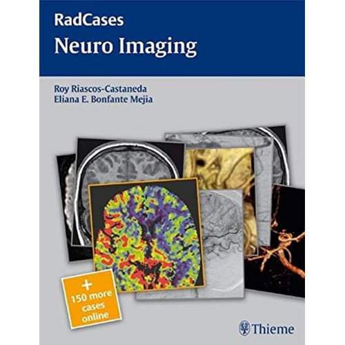 Radcases Neuro Imaging 