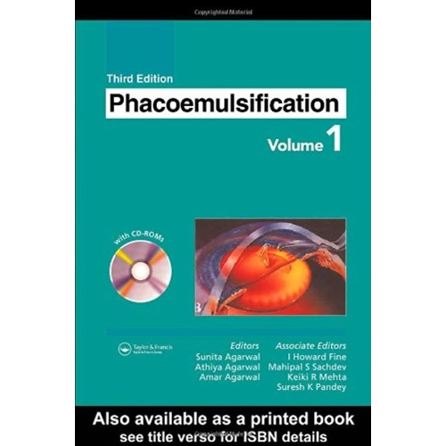 Phacoemulsification, 2 Vol. Set 