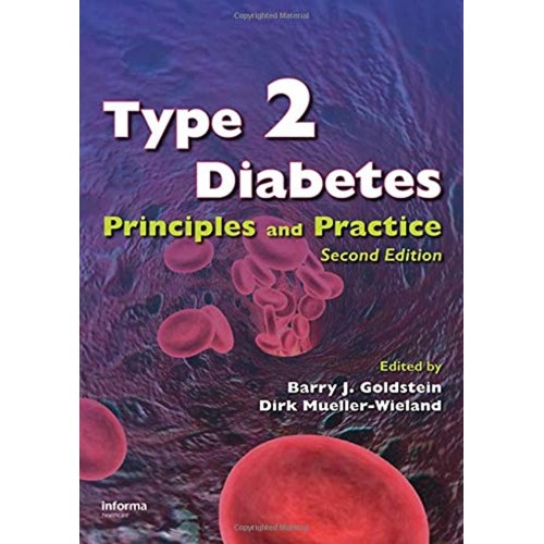 Type 2 Diabetes: Principles And Practice, Sec...