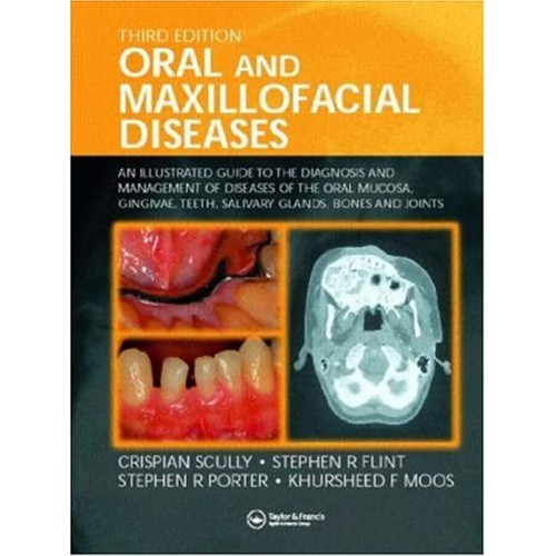 Oral And Maxillofacial Diseases 3E: An Illust...