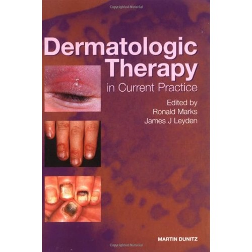 Dermatologic Treatment In Current Practice 