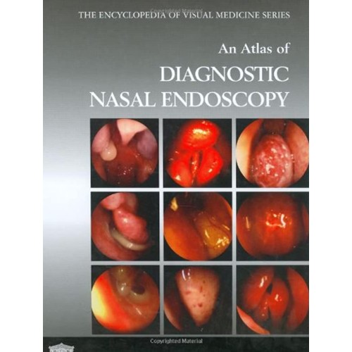 An Atlas Of Diagnostic Nasal Endoscopy (Encyc...