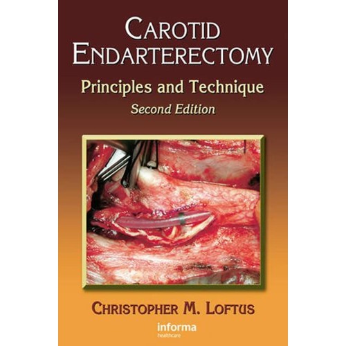 Carotid Endarterectomy Principles And Techniq...