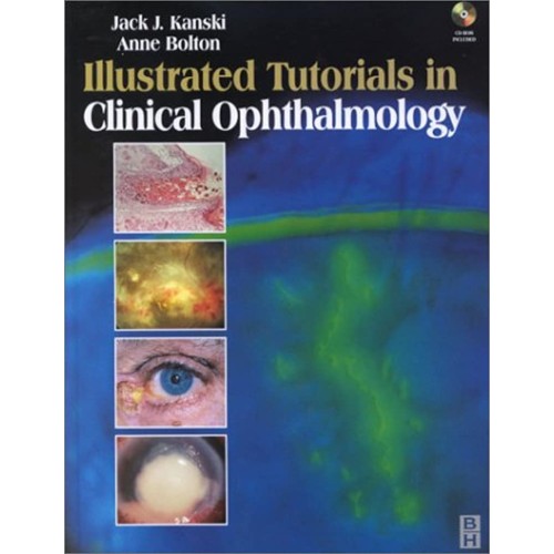 Illustrated Tutorials In Clinical Ophthalmolo...