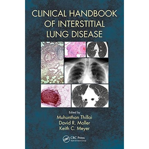 Clinical Handbook Of Interstitial Lung Diseas...