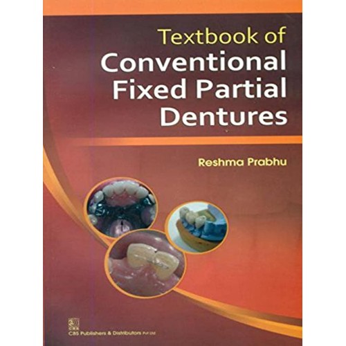 Textbook Of Conventional Fixed Partial Dentur...