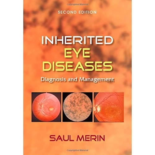 Inherited Eye Diseases Diagnosis And Manageme...