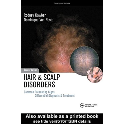 Hair And Scalp Disorders: Common Presenting S...