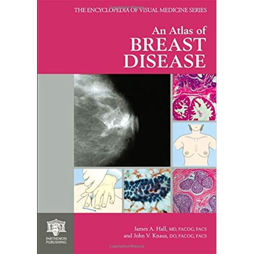 Atlas Of Breast Disease 