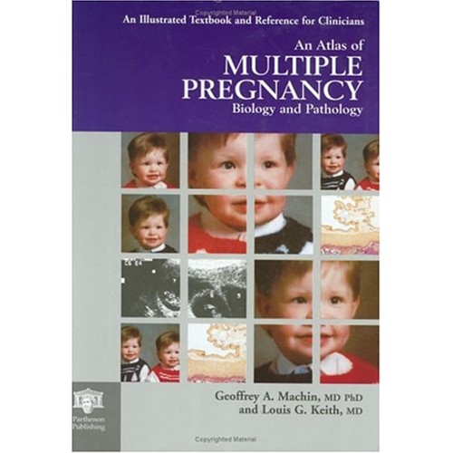 Atlas Of Multiple Pregnancy 