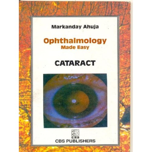 Ophthalmology Made Easy 