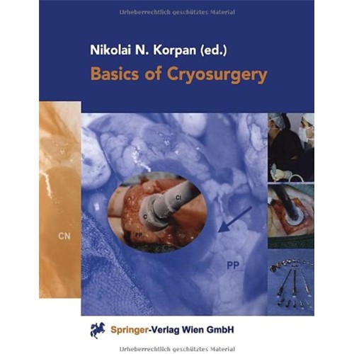 Basic Of Cryosurgery 