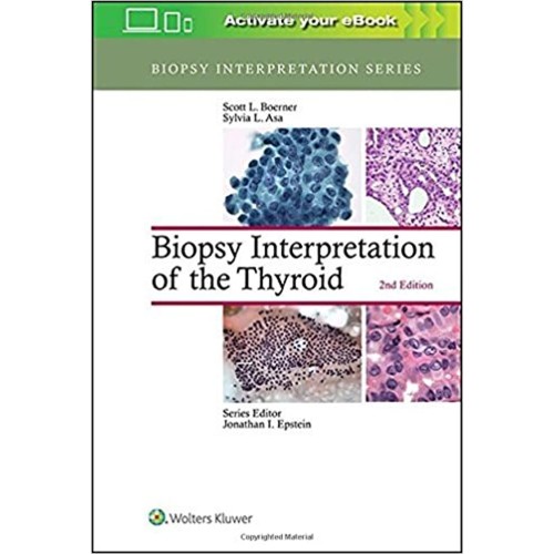 Biopsy Interpretation Of The Thyroid 2Ed (Hb ...