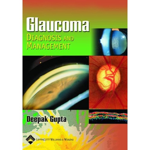 Glaucoma:Diagnosis & Management 