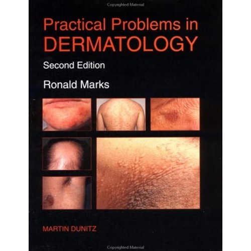 Practical Problems In Dermatology 2Ed (Pb 199...