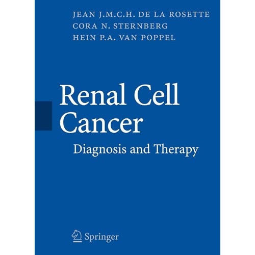 Renal Cell Cancer: Diagnosis And Therapy (Hb)...