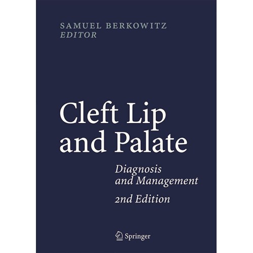 Cleft Lip And Palate Diagnosis And Management...