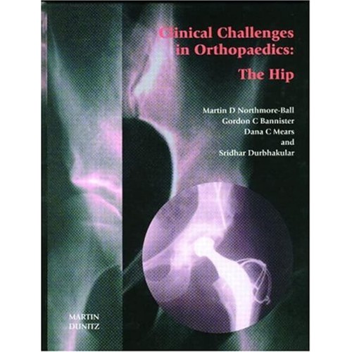 Clinical Challenges In Orthopaedics: Hip (200...