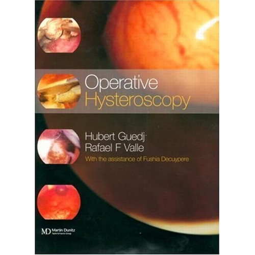 Operative Hysteroscopy 